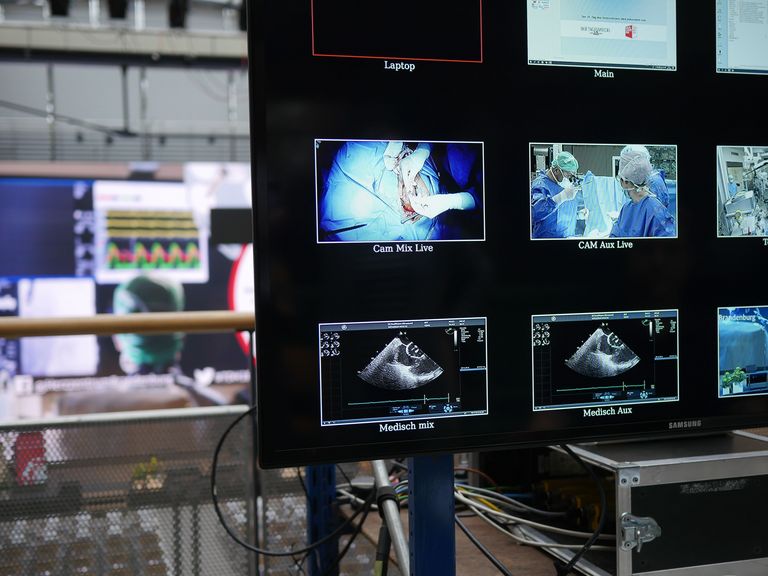 Eine Vielzahl Monitore mit Übertragungen vom Tag des Herzzentrums Brandenburg als Sinnbild für die Mediathek mit Multimedia-Inhalten